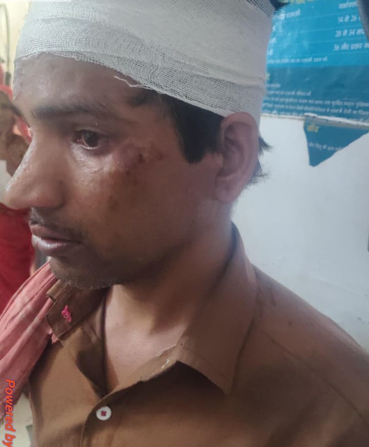 पुनावली में भालू का आतंक, दो ग्रामीणों पर किया हमला